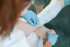 euroceptclinics_15_2025