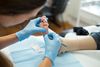 scherpdebridement